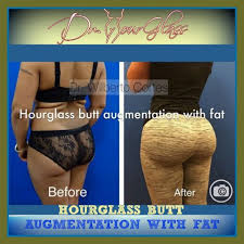 Pin On Before And After