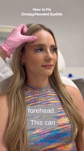 Struggling with droopy or heavy eyelids? 👁️ Wondering what your options  are? We’re here to help!, Book a consultation with one of our expert  injectors or Dr. Landmann who specializes in ...