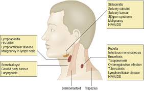Image result for Submandibular Exam