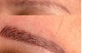 Ear wax removal in greenville, north carolina. 3d Microblading By Holistic Health And Hair Removal Clinic In Greenville Nc Alignable