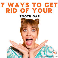 I hated how my teeth felt and looked. 7 Ways To Get Rid Of Your Tooth Gap Sportingsmiles