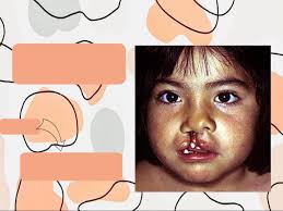 Embriología y Teratogénesis