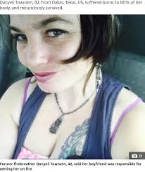 海外発！Breaking News】恋人に火を付けられ身体の80％を火傷した女性 暴力を受けても「この人しかいない」と信じていた（米）