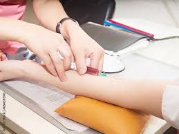 Image result for Hand Injection