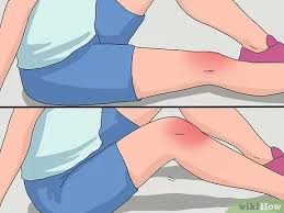 Maybe you would like to learn more about one of these? 4 Cara Untuk Merawat Lutut Yang Bengkak Wikihow