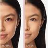 It mostly occurs due to an overproduction of melanin in the skin. 1