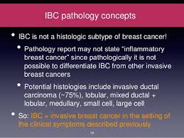 Inflammatory breast cancer is medically treated by chemotherapy first. Inflammatory Breast Cancer Ibc Information