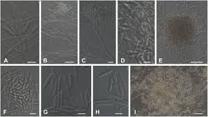 Image result for Cylindropsis