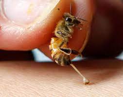 How Bee Sting Therapy Works Bee Venom Therapy Bee Venom Remedies For Bee Stings