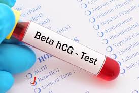 Hola, te sugiero volver a hacerte una prueba de sangre dentro de 5 días para que veas si tu nivel de hcg ha subido en flecha y si es así, ello te probará que estás realmente embarazada, pero si no es el caso, entonces tendrías que ir. Niveles Beta En El Embarazo Tabla E Interpretacion De Los Resultados Embarazo10 Com