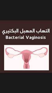 pin on ارشادات طبيبة أعراض أمراض افادة نصائح
