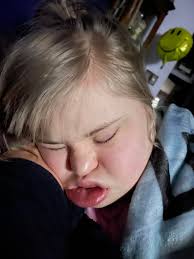 Macaylah's upcoming surgery to remove teeth due to constant pain