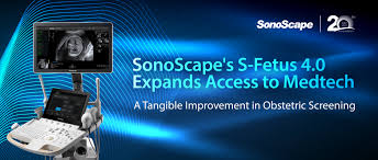 El S-Fetus 4.0 de SonoScape amplía el acceso a la tecnología ...
