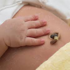 The best ingredients to use when cleaning are baby soap and warm water. Umbilical Cord Care Healthychildren Org