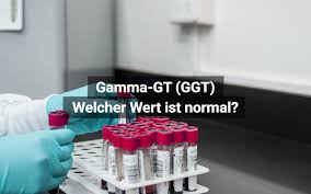 Wenn die leberwerte erhöht sind, sind zunächst nur unspezifische symptome wie leistungsabfall und müdigkeit die folge; Gamma Gt Ggt Tabelle Normalwerte Zu Hoch Praktischarzt