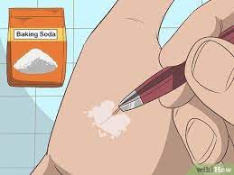 Image Titled Remove A Deep Splinter Step 5 Splinter Removal Getting Splinters Out Kid Life Hacks