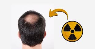 How can i handle fatigue? Can Emf Radiation Cause Hair Loss