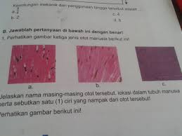 Quiz kontraksi otot quizizz di samping itu otot polos dapat dijumpai pada iris mata dan otot penggerak rambut soewolo 2003. Tolong Di Bantu Ya 1 Perhatikan Gambar Ketiga Jenis Otot Manusia Berikut Ini Jelaskan Nama Brainly Co Id