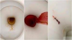 Mengapa bisa terjadi seperti itu? Obat Untuk Kencing Keluar Darah Pada Pria Di Apotik Obat Bak Berdarah