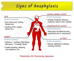 Death may occur within minutes but rarely has been reported to occur days to weeks after the initial anaphylactic event. Anaphylaxis Know More About It By Dr Radhika A Md Lybrate