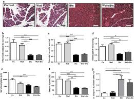 Check spelling or type a new query. The Protective Effect Of Betacellulin Against Acute Pancreatitis Is Erbb4 Dependent Springerlink