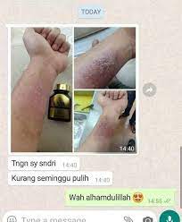 Kalau produk extra skin white yang pill tu ok tak.bahaya tak. Extra Skin White Esw Posts Facebook