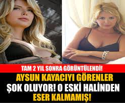 Check spelling or type a new query. Aysun Kayaci 2 Yil Sonra Goruntulendi Iste Son Hali Foto Galerisi