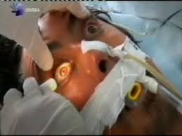Deben esperar veinte y cuatro horas para declarar muerte cerebral la verificación de los signos referidos en el muerte encefálica definicion medica actual de muerte cese permanente de la función del organismo como. Muerte Cerebral Signos Clinicos Video Dailymotion