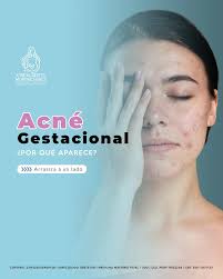 Dr. Jose Alberto Morfín