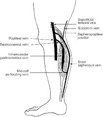 Most of the gastrocnemius muscle, together with each of the heads, are joined and inserted into the posterior surface of a wide membranous tendon. Incompetence Of The Gastrocnemius Vein Semantic Scholar