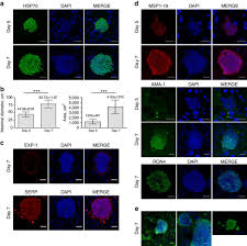 ❮ ❯ vidéos d'ile de france. Plasmodium Falciparum Full Life Cycle And Plasmodium Ovale Liver Stages In Humanized Mice Nature Communications
