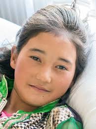 Dr Myra Elliott returns to Ladakh in 2016 for successful surgical treatment  of 20 cleft palate patients