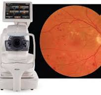 CRSToday | The Next-Generation Automated OCT and Fundus ...