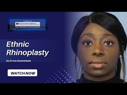 Before and After Ethnic Rhinoplasty (nose job)