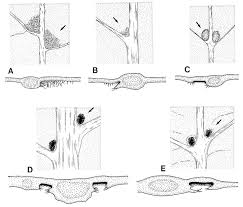 Image result for Tricalysia sp. E
