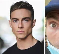 Actor gives contact lens warning after sight scare