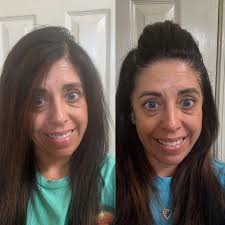 Skin Care Success with Radiansome 100 at 71 Years Old