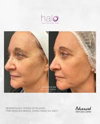 Dermatology Center of Atlanta