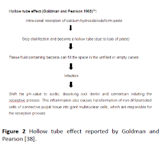 Official web page of pulpotec. Obturating Materials Used For Pulpectomy In Primary Teeth A Review Insight Medical Publishing