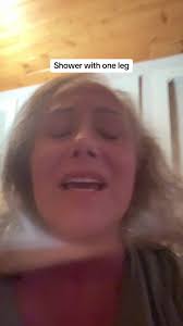 Washing Broken Leg First Time Soap Surgery