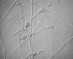 Image result for Pittosporum mildbraedii