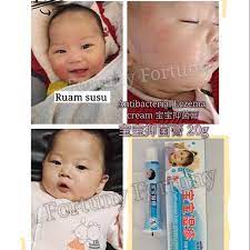 Ramai ibu yang bekerja mengalami dilemma memberikan anak mereka susu formula atau susu tepung berasaskan susu lembu. Buy Ready Stock Baby Ekzema Treatment Cream Bayi Krim Ekzema Hilang Gatal Ruam Susu Seetracker Malaysia