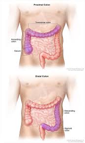 Is a punctuation mark consisting of two equally sized dots placed one above the other on the same vertical line. Colorectal Cancer Survival Linked To Tumor Location National Cancer Institute