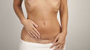 On a envie de faire l'amour tout le temps ou du moins très fréquemment ! Comment Se Remettre D Une Cesarienne Doctissimo