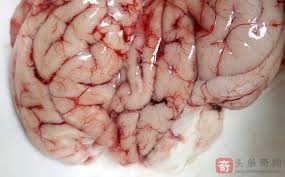Manage your video collection and share your thoughts. æ­»äº¡çŒªè„'éƒ¨åˆ† å¤æ´» è„'æ­»äº¡å°†é‡æ–°ç•Œå®šæ­»äº¡ å›¾æ–‡ åŠ ç²— å¤æ´»