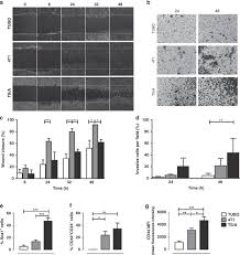 But her risk of developing colon and rectal cancer before the age of 50 is 0.3 percent, or about 3 out of every 1,000 women. Tumour Acidosis Evaluated In Vivo By Mri Cest Ph Imaging Reveals Breast Cancer Metastatic Potential British Journal Of Cancer