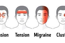 Jenis sakit kepala ini sering diartikan sebagai keluhan yang muncul akibat kolesterol tinggi atau tekanan darah tinggi. Mudah Usir Sakit Kepala Dalam 5 Menit Tanpa Obat Dengan Cara Ini