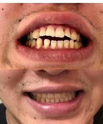 Fernandez Dental Clinic (@nennettes.fernandez) • Instagram photos and videos