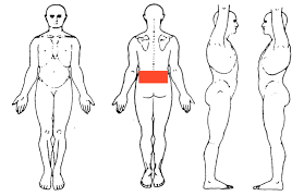 Case Example 1 Lumbar Pain Markgibsonphysio