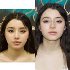 ARMONIZACIÓN FACIAL. Nuestra Representante Nacional en manos de su amigo el  Dr. Jesus Magallanes